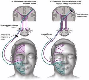 Avoiding danger facial facial in injury nerve plastic surgery zone