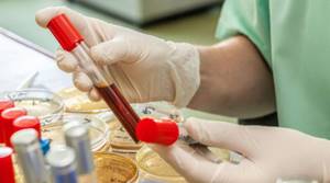 АСТ повышен в крови более 8 причин, что это значит, норма