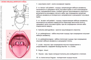 Рак голосовых связок фото