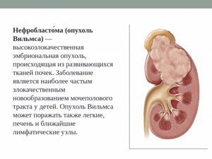 нефробластома опухоль вильмса микропрепарат, нефробластома метастазирование, нефробластома (опухоль вильмса) патологическая анатомия