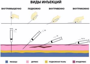 Куда колоть инсулин собаке фото