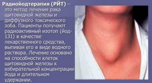 Классификация злокачественных новообразований в щитовидной железе