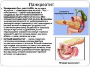 Воспаление поджелудочной железы, симптомы панкреатита