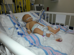 Атрезия желчевыводящих путей у новорожденных детей: билиарная и тотальная, лечение