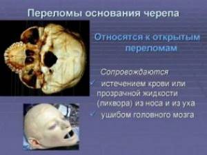 Последствия после перелома свода и основания черепа