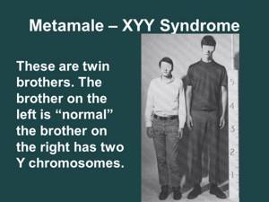 Признаки и симптомы XYY-синдрома