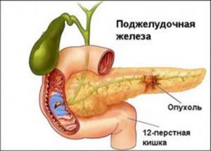 Чем опасны высокий и низкий сахар?