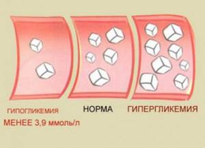 Показания глюкометра при сахарном диабете