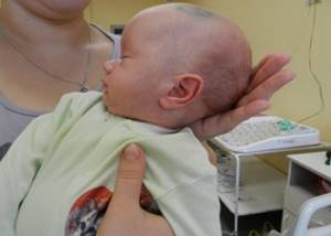 Как выявить неврологическую патологию у малыша