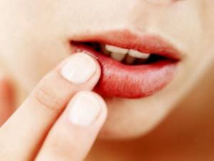 Папиллома на слизистой рта симптомы и причины появления вируса