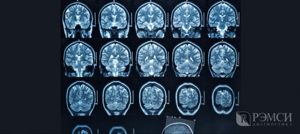 Виды исследований головного мозга