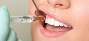 Процедура удаления зуба