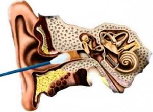 Пульсирующий шум в ухе – куда обращаться и как вылечить?