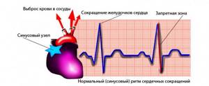 Нормальные показатели в кардиограмме