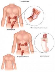 Краткие анатомо-физиологические особенности кишечного пищеварения