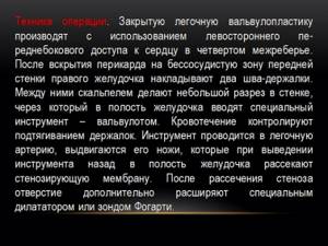 Операция Операция