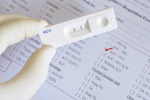 Положительный анализ на гепатит с при беременности