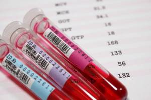 Нормы тромбоцитов в крови и расшифровка результатов