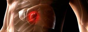 Как выявить HCV на ранней стадии Как выявить HCV на ранней стадии