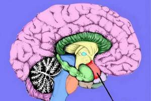 Эктопия миндалины мозжечка: причины, симптомы, терапевтические мероприятия