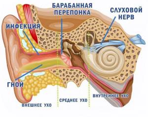 Воспаление внутреннего уха: симптомы