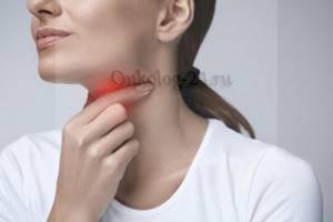 Киста в горле — опасна ли она, как проявляется, медикаментозное и оперативное лечение, удаление кисты гортани