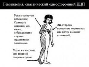 О заболевании О заболевании