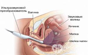 Диагностика Диагностика