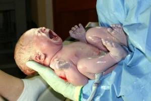 Почему возникает гемолитическая желтуха младенцев?