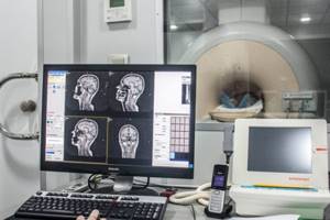 Опасно ли сканировать людей с травмой головы?