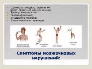 Кружится голова и шатает при ходьбе: причины, симптомы, лечение Кружится голова и шатает при ходьбе: причины, симптомы, лечение