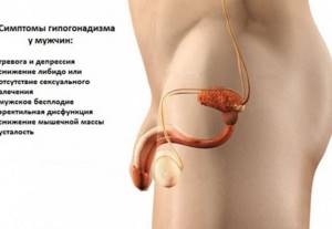 Мужской гипогонадизм: причины, симптомы и лечение Мужской гипогонадизм: причины, симптомы и лечение