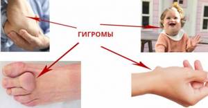Классификация по месту локации Классификация по месту локации