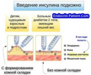 Правила введения инсулина, куда и как колоть